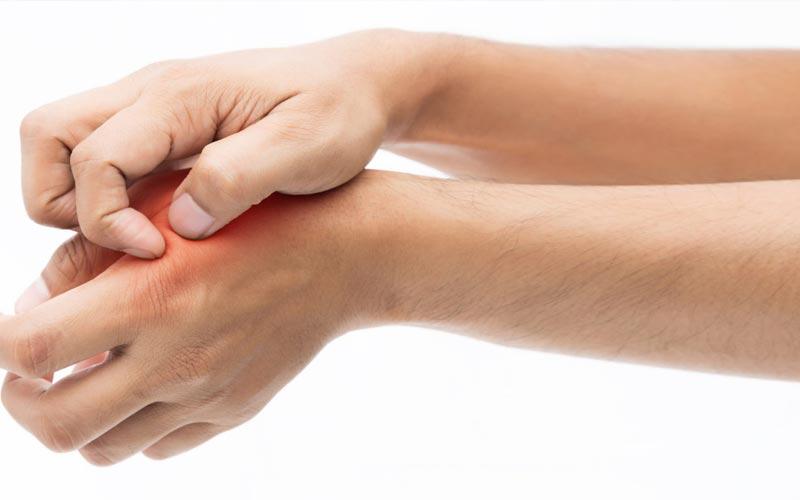 تاثیر بیماری های نادر پوستی بر کیفیت زندگی